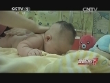幼儿湿疹不能用激素类药膏?