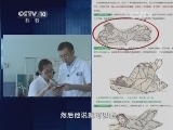 暑期特别节目（五）网传腰间盘突出症治理方法是真的吗